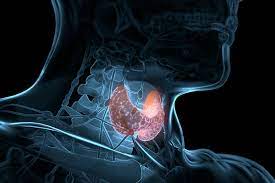 cancer-de-tiroides-2